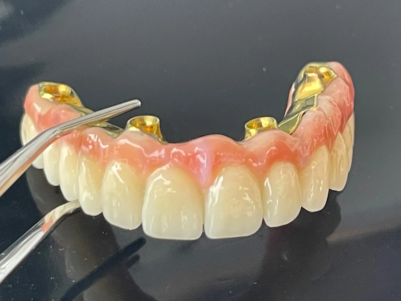 Leistungen - Gebiss mit Zange