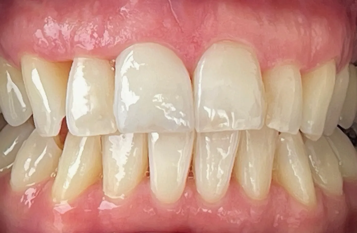 Leistungen - Patientenfoto - Nachher