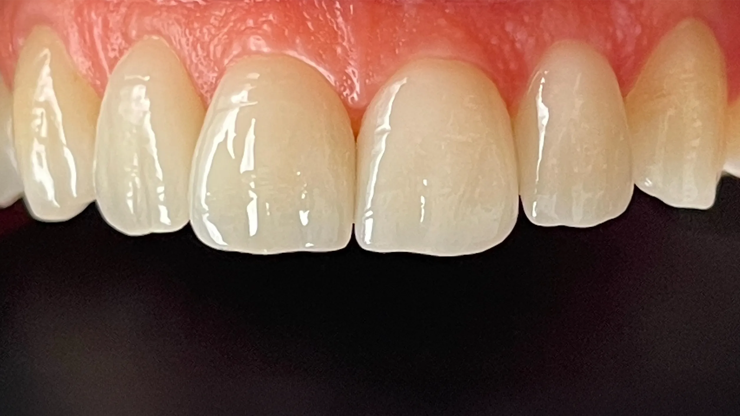 Patientenfoto - Nachher 3