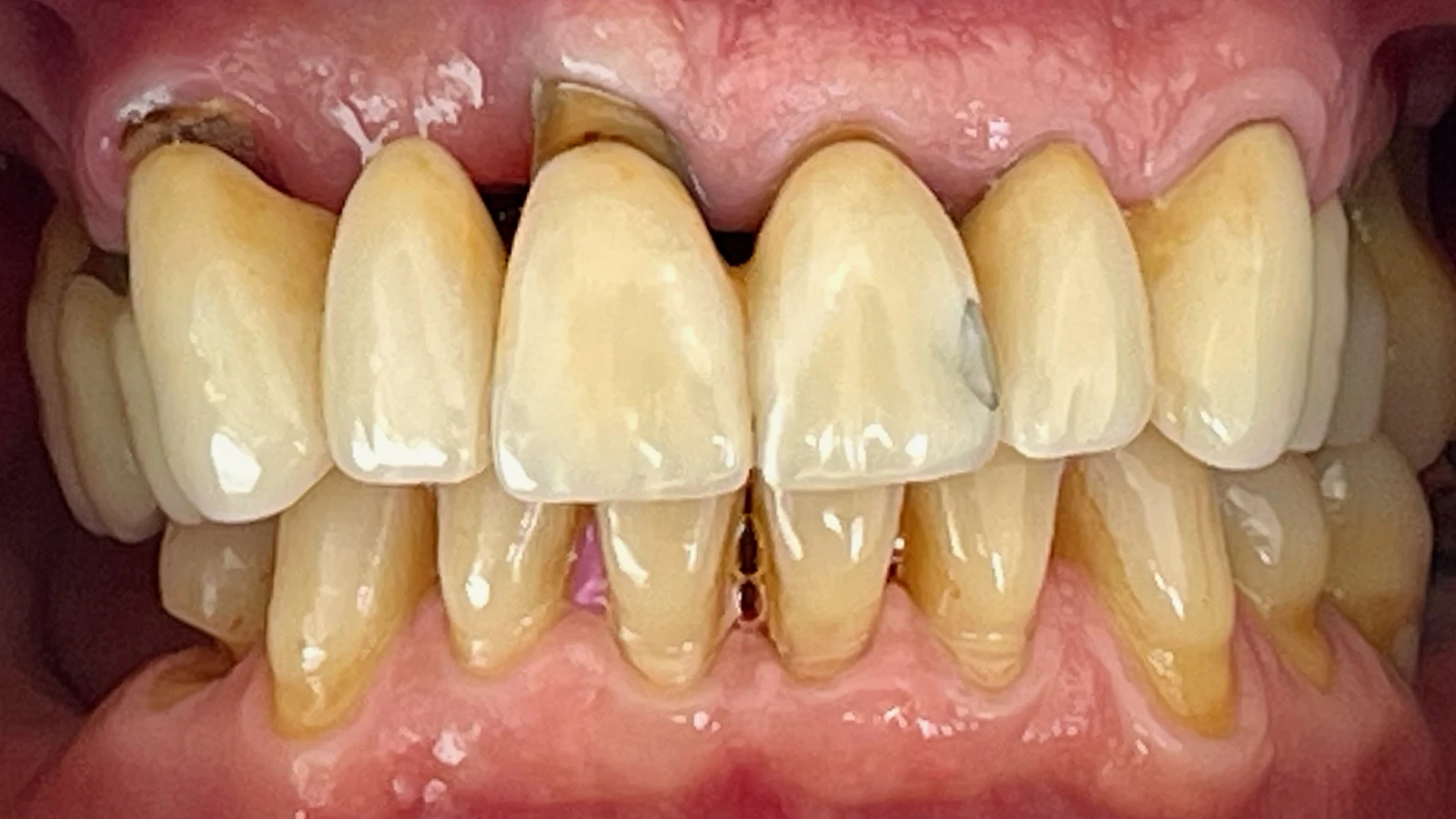 Leistungen - Patientenfoto vorher