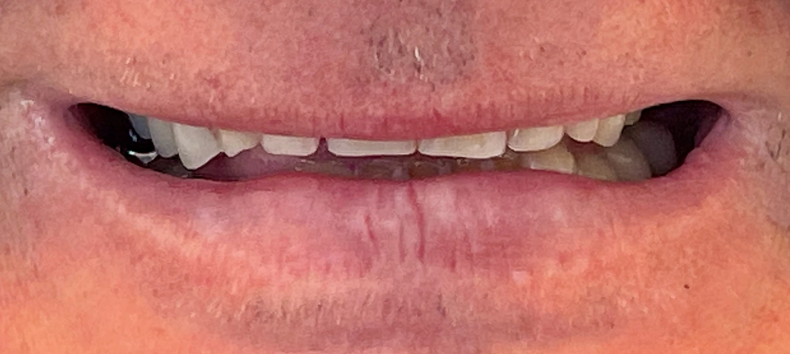 Patientenfoto - Vorher