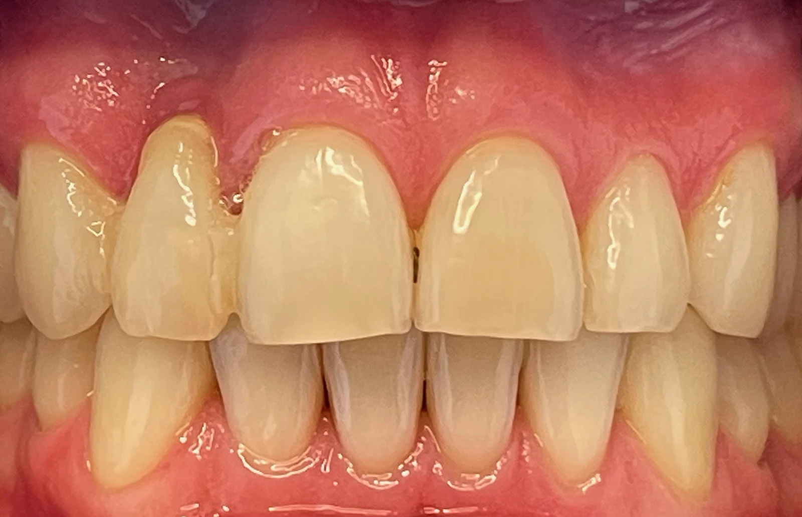 Patientenfoto - Vorher