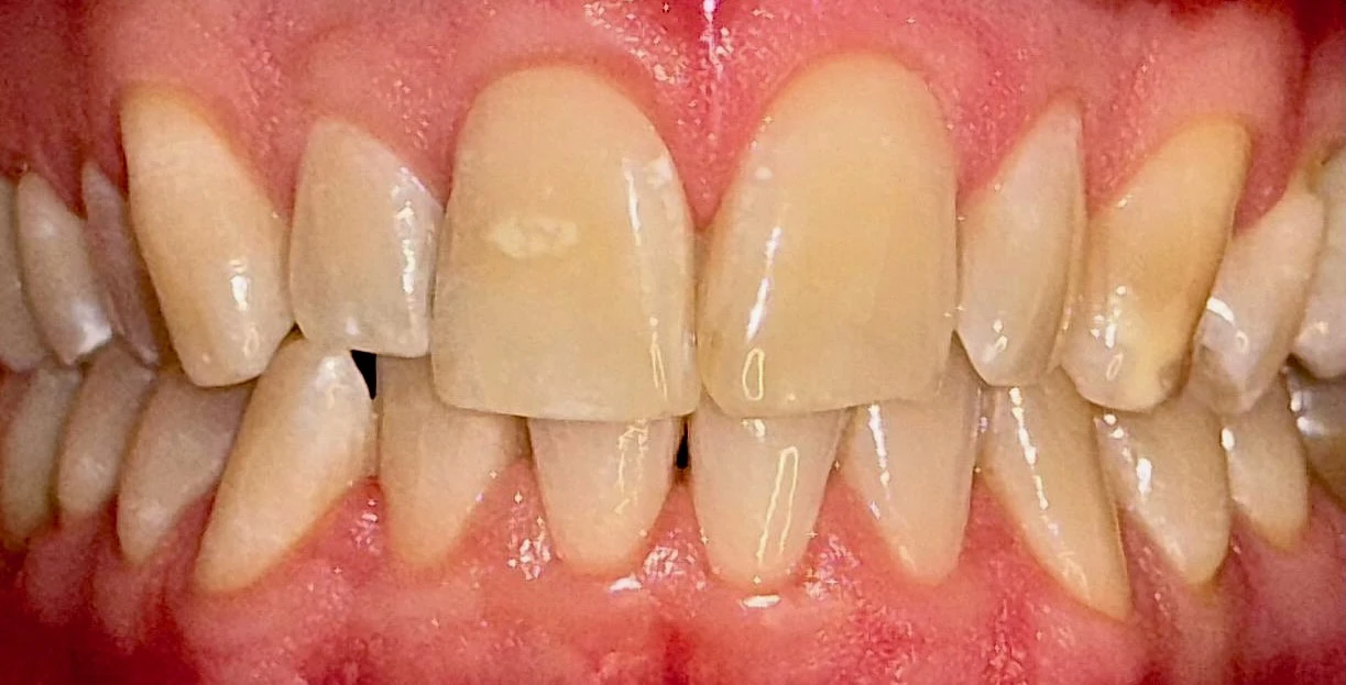 Patientenfoto - Vorher