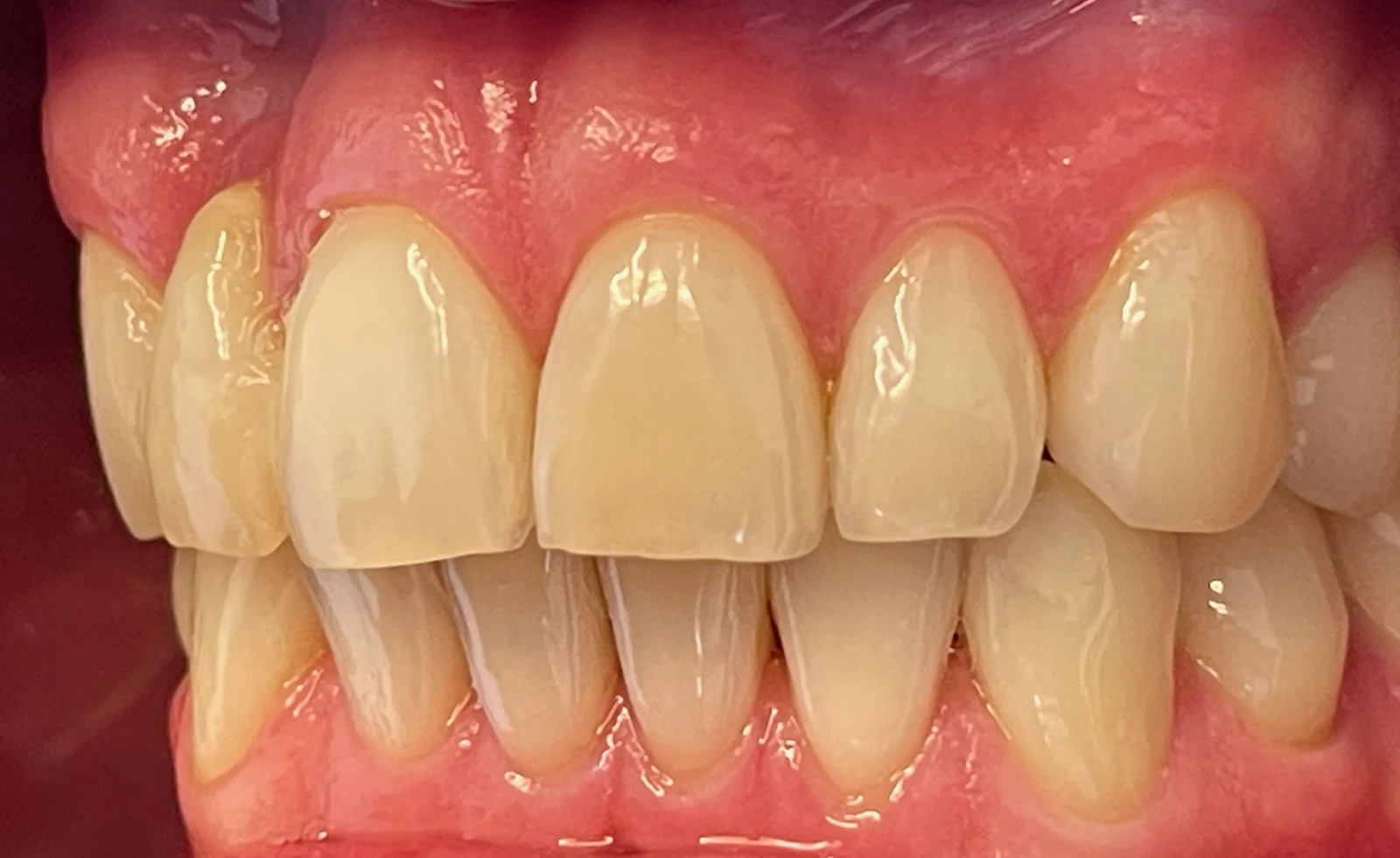 Patientenfoto - Vorher