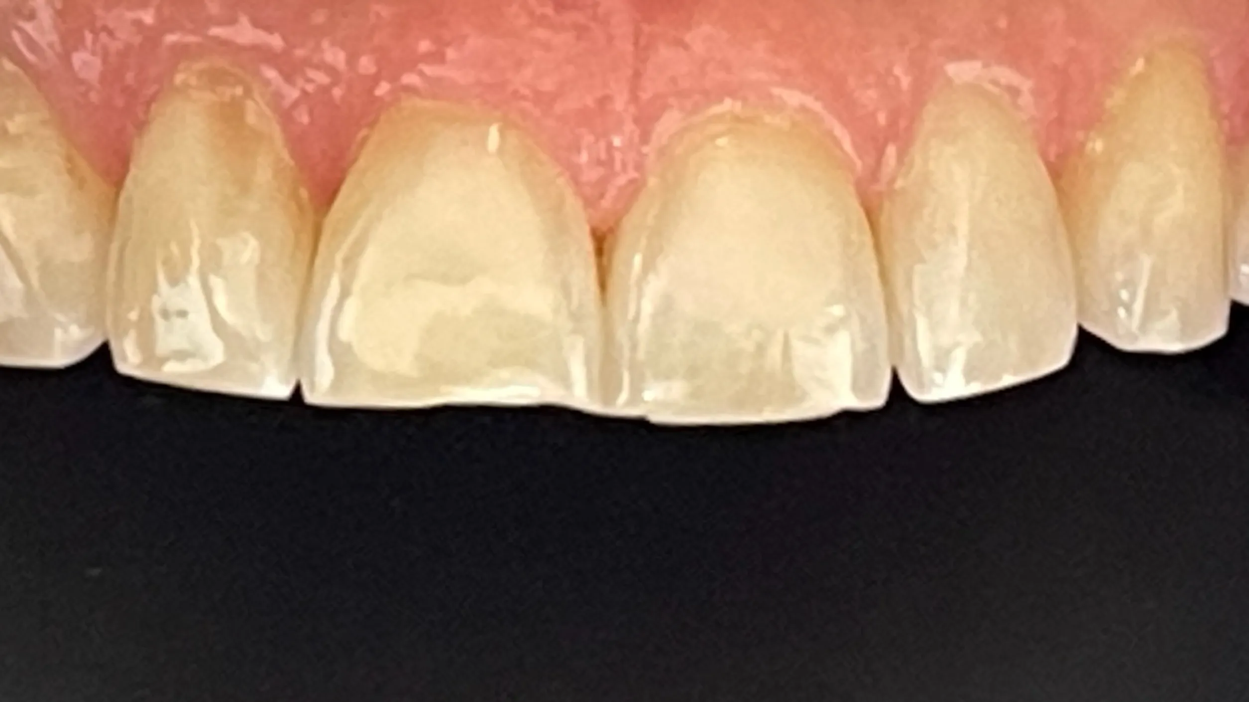 Patientenfoto - Vorher