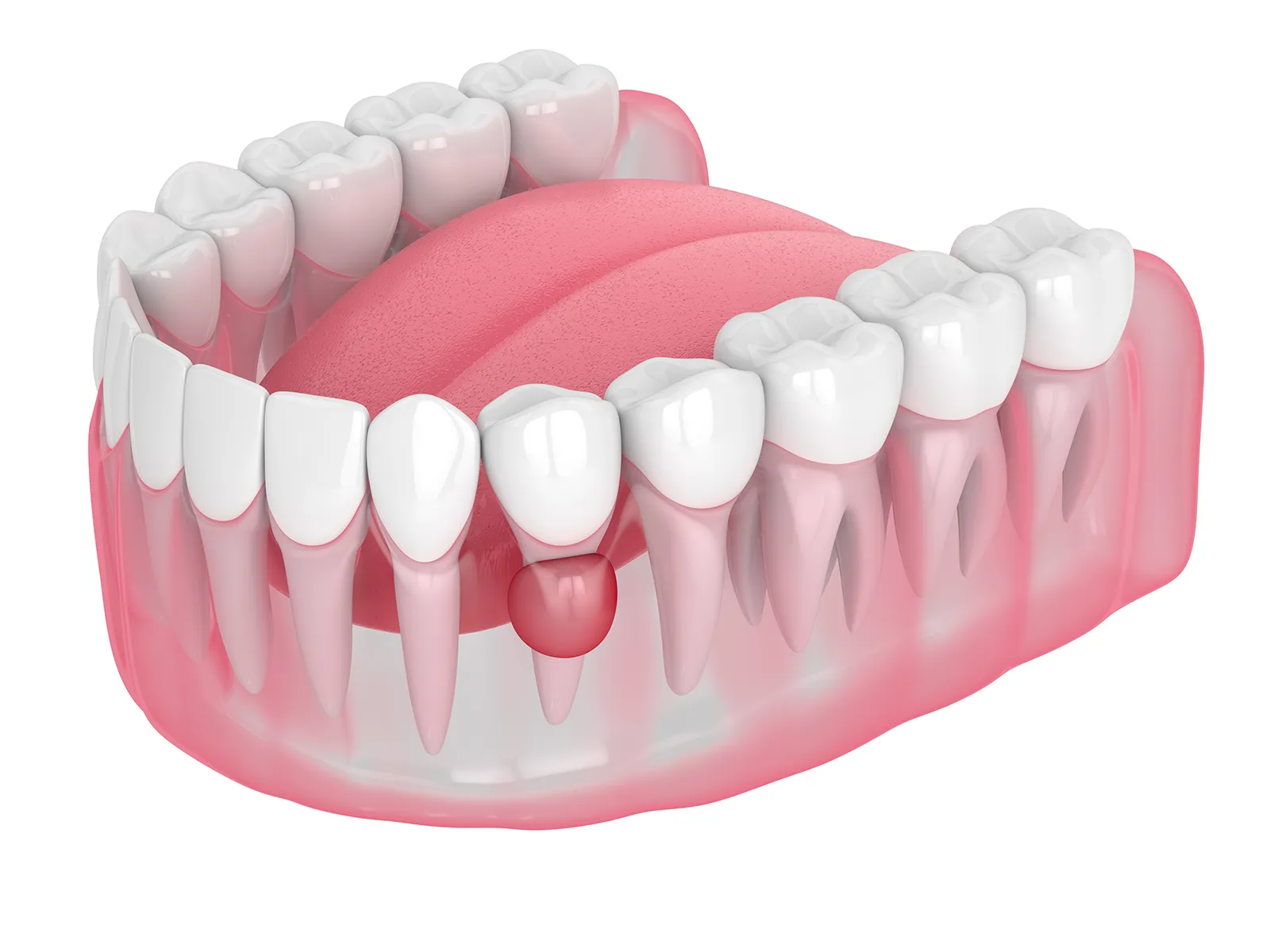 Dr. Crepaz - Leistungen - Biopsien