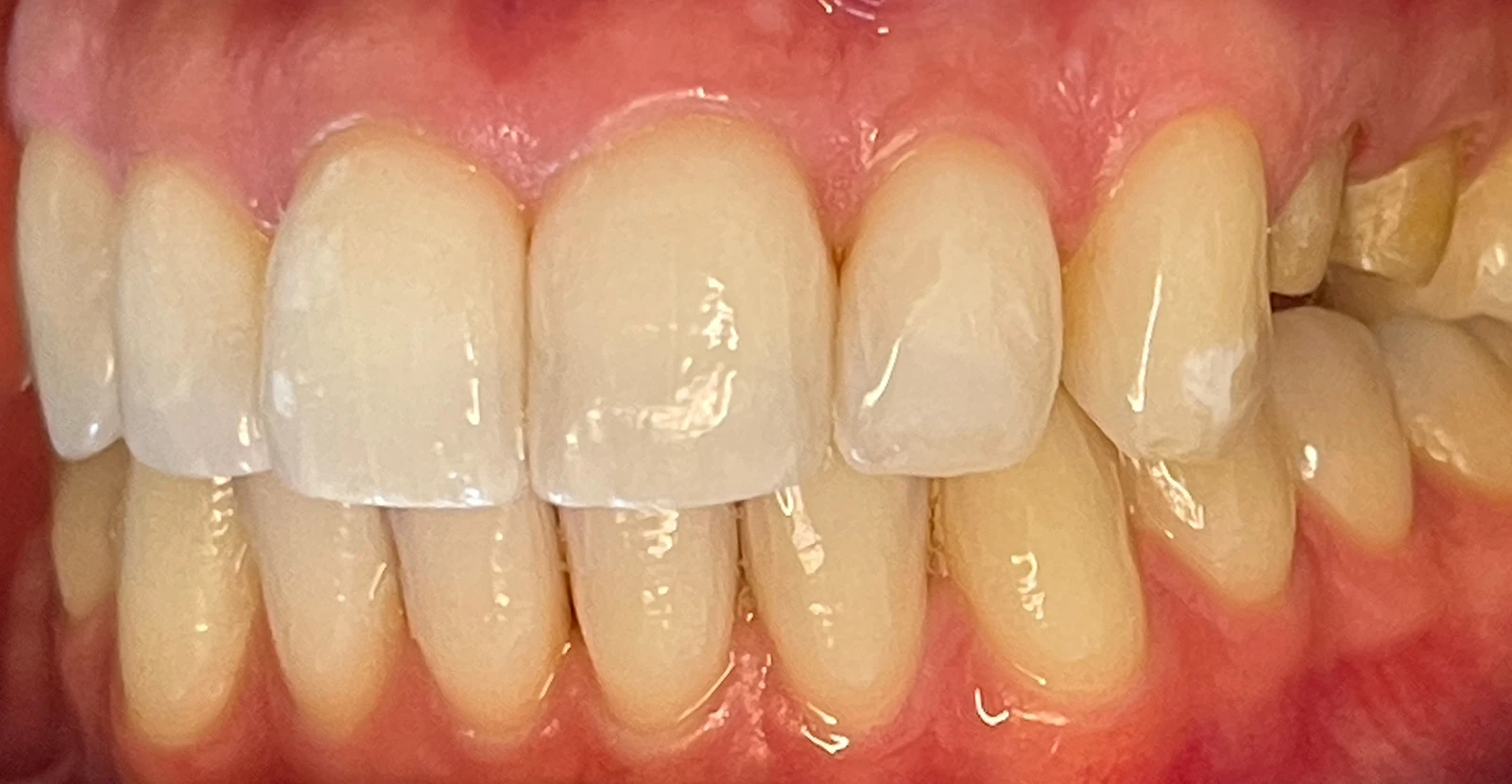 Patientenfoto - Vorher